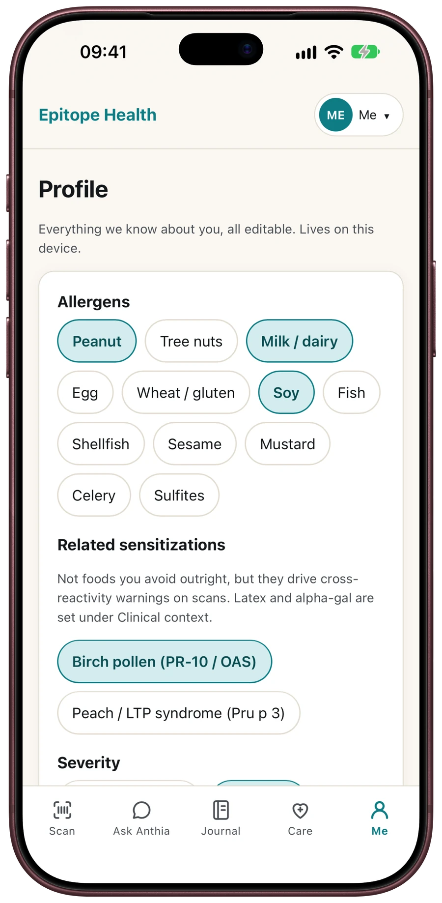 Epitope Health on iPhone 18 Pro Max in Burgundy, showing the allergy profile: allergens and related sensitizations